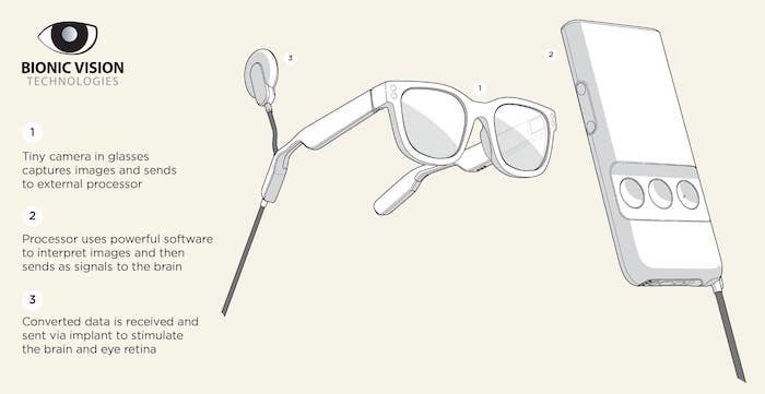 A Bionic Eye Is Set To Hit Stores In 2025! | Women Love Tech